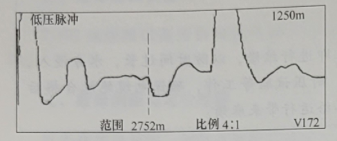 图7-2电缆接头波形